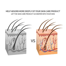 Load image into Gallery viewer, Facial Mesotherapy Electroporation LED Photon